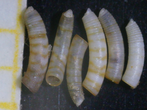 Caecum trachea