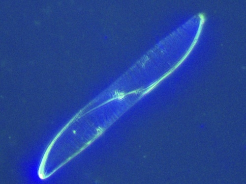 Carinasigma rectum